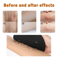 4-in-1 Exfoliating Scrubber Set | Reveal Silky Smooth Skin In Every Shower(4PCS)